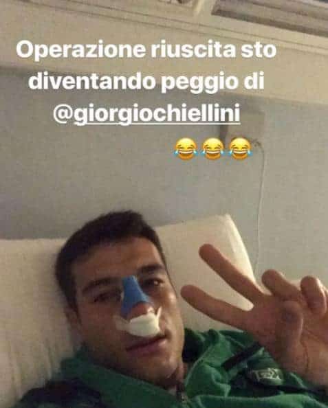 Sassuolo, Peluso ironico dopo l'operazione al naso: "Sto diventando peggio di Chiellini"
